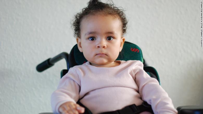 Ayah is 14 months old and suffers from spinal muscular atrophy, which affects one in 10,000 children